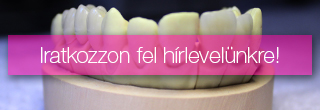 banner hirlevel